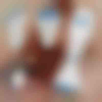 Pente elétrico para remoção de piolhos | TREVY